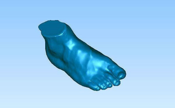 醫(yī)療3D打印機定制矯正器(圖4) 醫(yī)療3D打印機定制矯正器(圖4)