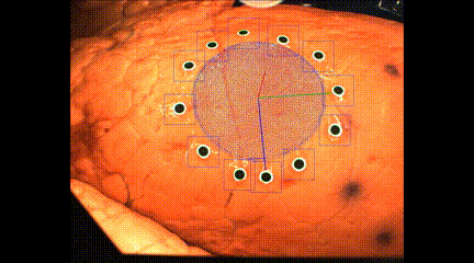 3D打印新成果!新技術或將助力診斷監測新冠肺炎(圖2)