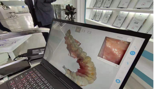 3D打印技術(shù)在牙科義齒領(lǐng)域中牙套制作的應(yīng)用是怎樣的呢?(圖2) 3D打印技術(shù)在牙科義齒領(lǐng)域中牙套制作的應(yīng)用是怎樣的呢?(圖2)